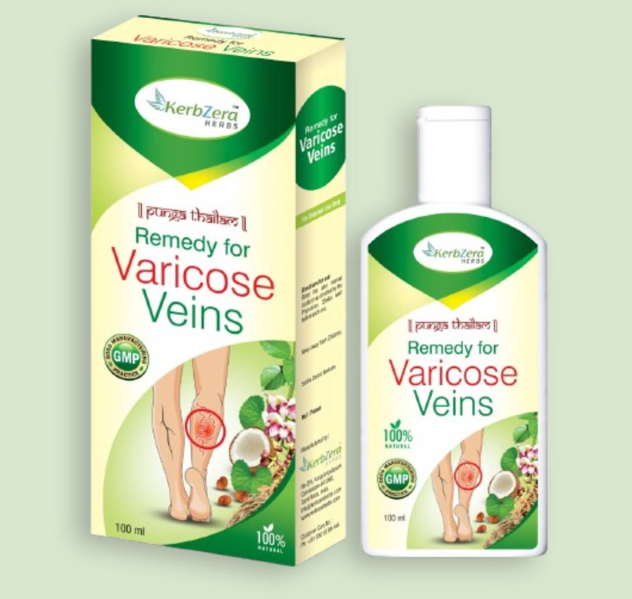 Varicose veins